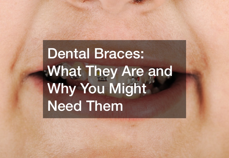 are braces orthodontics