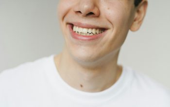 how to get rid of yellow teeth