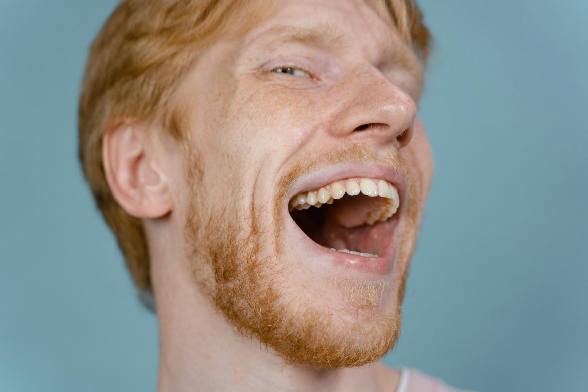 are teeth naturally yellow